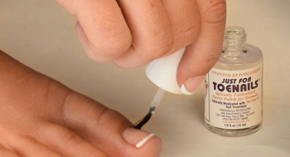 vernis à ongles champignon sur le gros orteil