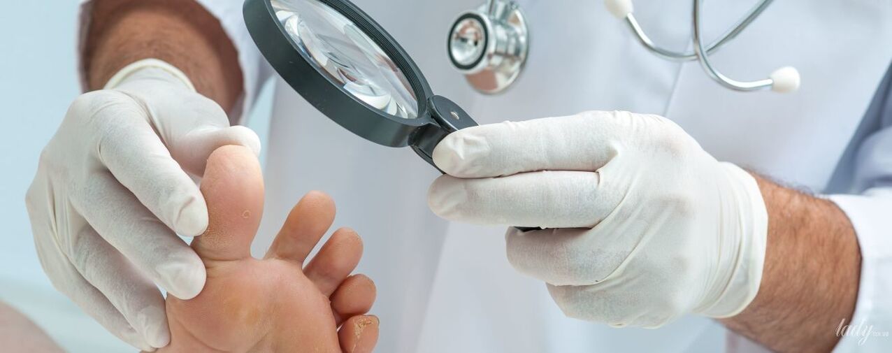 Le médecin examine le champignon à la pointe