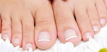 Prévention de l'apparence du champignon sur les ongles des jambes