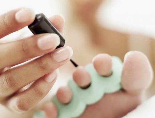 traiter les ongles avec du vernis à ongles pour une infection fongique